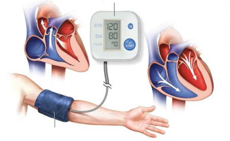 Pulmoner Arteriyel Hipertansiyon